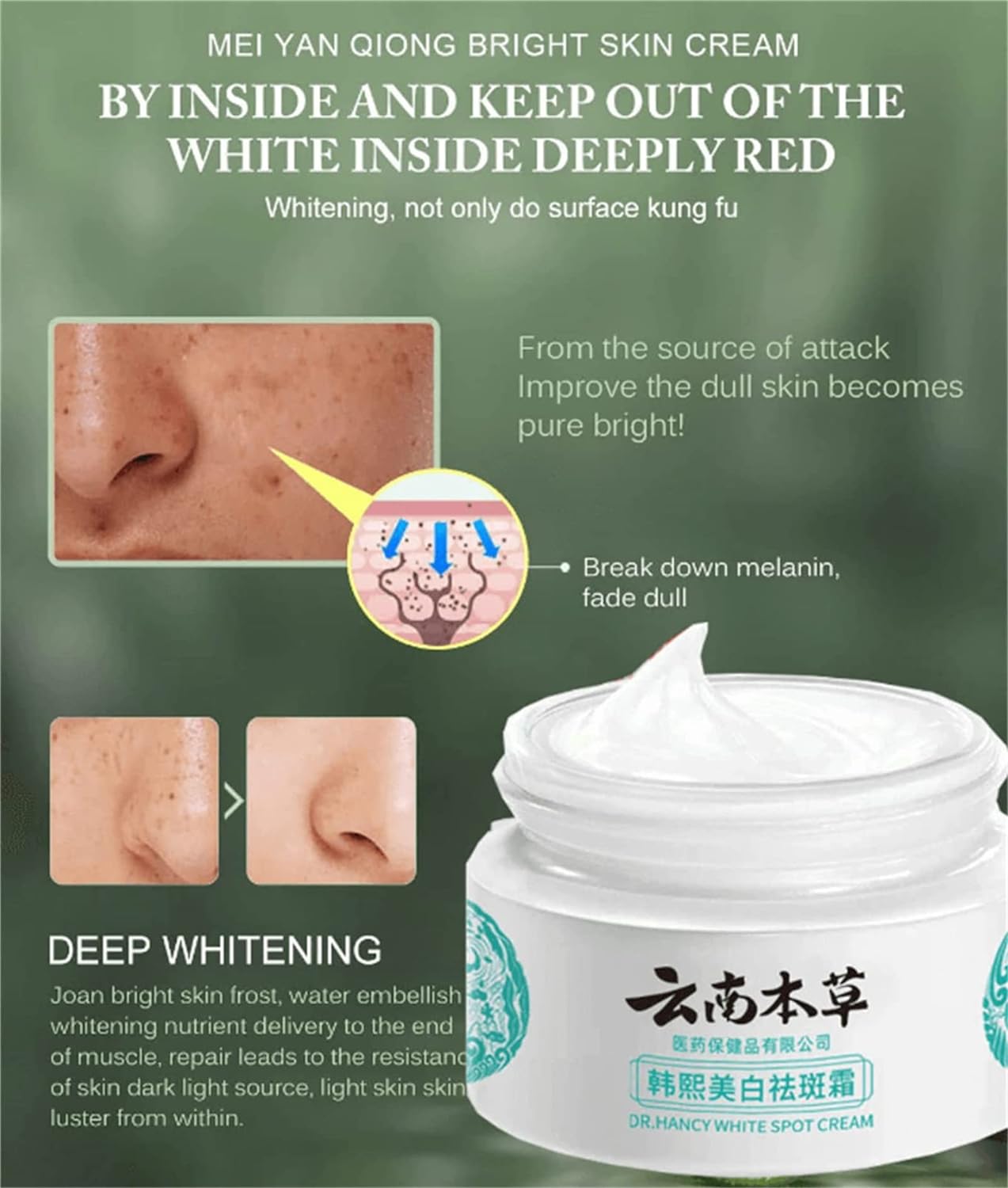 Japanese Melasma Cream AKA Dr.Hancy White Spot Cream - 20g