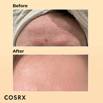 COSRX Advanced Snail Cream and Essence Combo