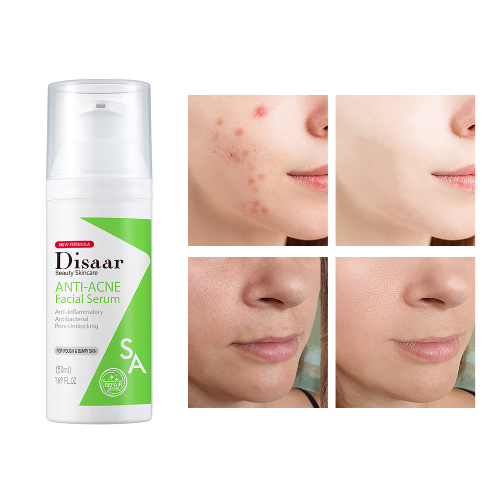 Disaar Anti-Acne Facial Serum - 50ml