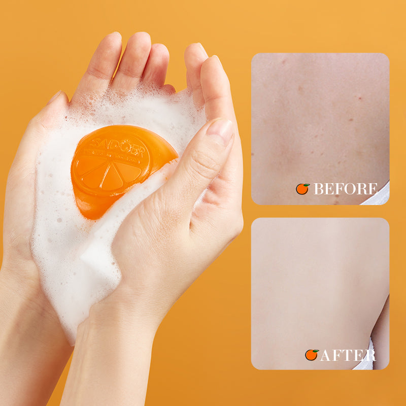 Sadoer Vitamin C Whitening Soap - 100g