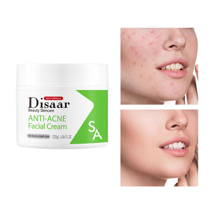 Disaar SA Anti-Acne Facial Cream - 120g