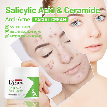 Disaar SA Anti-Acne Facial Cream - 120g