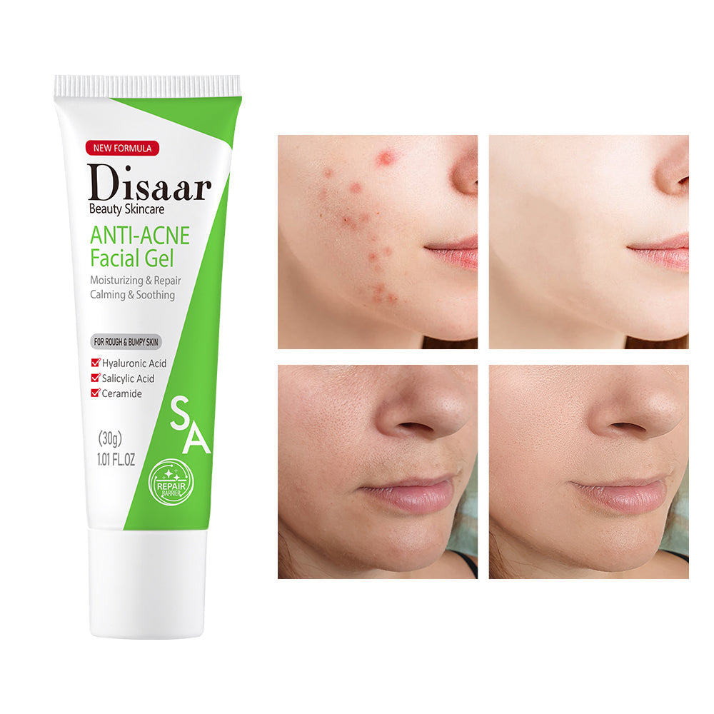 Disaar SA Anti-Acne Facial Gel - 30g